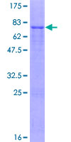 IPMK Protein - 12.5% SDS-PAGE of human IPMK stained with Coomassie Blue