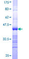 IPMK Protein - 12.5% SDS-PAGE Stained with Coomassie Blue.