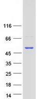 IPMK Protein - Purified recombinant protein IPMK was analyzed by SDS-PAGE gel and Coomassie Blue Staining
