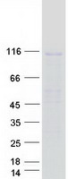IPO11 / Importin 11 Protein - Purified recombinant protein IPO11 was analyzed by SDS-PAGE gel and Coomassie Blue Staining