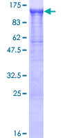 IPO13 / LGL2 Protein - 12.5% SDS-PAGE of human IPO13 stained with Coomassie Blue