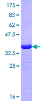 IPO7 / RANBP7 Protein - 12.5% SDS-PAGE Stained with Coomassie Blue.