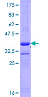 IPO8 / Importin 8 Protein - 12.5% SDS-PAGE Stained with Coomassie Blue.