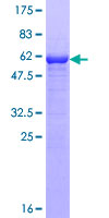 IPP2 / PPP1R2 Protein - 12.5% SDS-PAGE of human PPP1R2 stained with Coomassie Blue