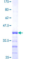 IPP2 / PPP1R2 Protein - 12.5% SDS-PAGE Stained with Coomassie Blue.