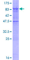 IPPK Protein - 12.5% SDS-PAGE of human IPPK stained with Coomassie Blue