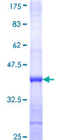 IPPK Protein - 12.5% SDS-PAGE Stained with Coomassie Blue.