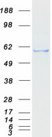 IPPK Protein - Purified recombinant protein IPPK was analyzed by SDS-PAGE gel and Coomassie Blue Staining