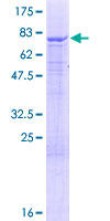 IQCB1 Protein - 12.5% SDS-PAGE of human IQCB1 stained with Coomassie Blue