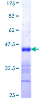 IQCB1 Protein - 12.5% SDS-PAGE Stained with Coomassie Blue.