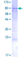 IQCC Protein - 12.5% SDS-PAGE of human IQCC stained with Coomassie Blue