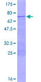 IQCD Protein - 12.5% SDS-PAGE of human IQCD stained with Coomassie Blue