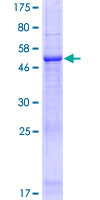 IQCF1 Protein - 12.5% SDS-PAGE of human IQCF1 stained with Coomassie Blue