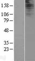 IQCF2 Protein - Western validation with an anti-DDK antibody * L: Control HEK293 lysate R: Over-expression lysate