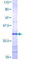 IQCH Protein - 12.5% SDS-PAGE Stained with Coomassie Blue.