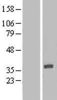 IQCK Protein - Western validation with an anti-DDK antibody * L: Control HEK293 lysate R: Over-expression lysate