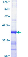 IQGAP1 Protein - 12.5% SDS-PAGE Stained with Coomassie Blue.
