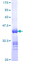 IQGAP2 Protein - 12.5% SDS-PAGE Stained with Coomassie Blue.