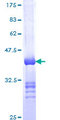 IQGAP2 Protein - 12.5% SDS-PAGE Stained with Coomassie Blue.