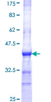 IQGAP3 Protein - 12.5% SDS-PAGE Stained with Coomassie Blue.