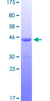 IRAK1 / IRAK Protein - 12.5% SDS-PAGE Stained with Coomassie Blue.