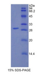 IRAK1 / IRAK Protein - Recombinant Interleukin 1 Receptor Associated Kinase 1 By SDS-PAGE