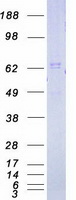 IRAK1 / IRAK Protein - Purified recombinant protein IRAK1 was analyzed by SDS-PAGE gel and Coomassie Blue Staining