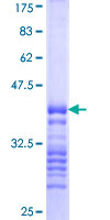 IRAK2 / IRAK-2 Protein - 12.5% SDS-PAGE Stained with Coomassie Blue