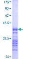 IRAK2 / IRAK-2 Protein - 12.5% SDS-PAGE Stained with Coomassie Blue