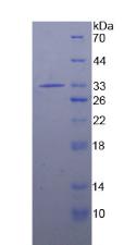 IRAK2 / IRAK-2 Protein - Recombinant Interleukin 1 Receptor Associated Kinase 2 By SDS-PAGE