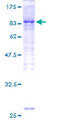 IRAK3 / IRAKM / IRAK-M Protein - 12.5% SDS-PAGE of human IRAK3 stained with Coomassie Blue