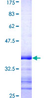 IRAK3 / IRAKM / IRAK-M Protein - 12.5% SDS-PAGE Stained with Coomassie Blue.