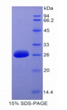 IRAK3 / IRAKM / IRAK-M Protein - Recombinant Interleukin 1 Receptor Associated Kinase 3 By SDS-PAGE