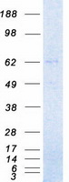 IRAK3 / IRAKM / IRAK-M Protein - Purified recombinant protein IRAK3 was analyzed by SDS-PAGE gel and Coomassie Blue Staining