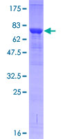 IRAK4 / IRAK-4 Protein - 12.5% SDS-PAGE of human IRAK4 stained with Coomassie Blue
