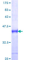 IRAK4 / IRAK-4 Protein - 12.5% SDS-PAGE Stained with Coomassie Blue.