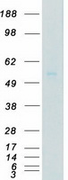 IRAK4 / IRAK-4 Protein - Purified recombinant protein IRAK4 was analyzed by SDS-PAGE gel and Coomassie Blue Staining