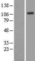 IREB2 / IRP2 Protein - Western validation with an anti-DDK antibody * L: Control HEK293 lysate R: Over-expression lysate