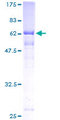 IREB2 / IRP2 Protein - 12.5% SDS-PAGE of human IREB2 stained with Coomassie Blue
