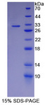 IREB2 / IRP2 Protein - Recombinant  Iron ResPonsive Element Binding Protein 2 By SDS-PAGE