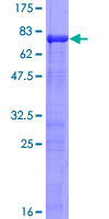 IRF2 Protein - 12.5% SDS-PAGE of human IRF2 stained with Coomassie Blue