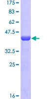 IRF2 Protein - 12.5% SDS-PAGE Stained with Coomassie Blue.