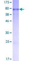 IRF3 Protein - 12.5% SDS-PAGE of human IRF3 stained with Coomassie Blue
