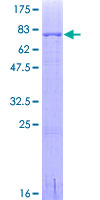 IRF4 Protein - 12.5% SDS-PAGE of human IRF4 stained with Coomassie Blue