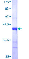IRF4 Protein - 12.5% SDS-PAGE Stained with Coomassie Blue.