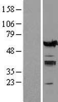 IRF5 Protein - Western validation with an anti-DDK antibody * L: Control HEK293 lysate R: Over-expression lysate