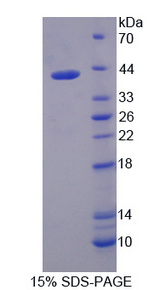 IRF5 Protein - Recombinant Interferon Regulatory Factor 5 By SDS-PAGE