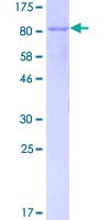 IRF5 Protein - 12.5% SDS-PAGE of human IRF5 stained with Coomassie Blue