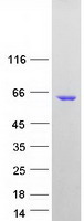 IRF5 Protein - Purified recombinant protein IRF5 was analyzed by SDS-PAGE gel and Coomassie Blue Staining