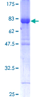 IRF6 Protein - 12.5% SDS-PAGE of human IRF6 stained with Coomassie Blue